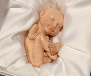 3D Printed Ultrasound Baby